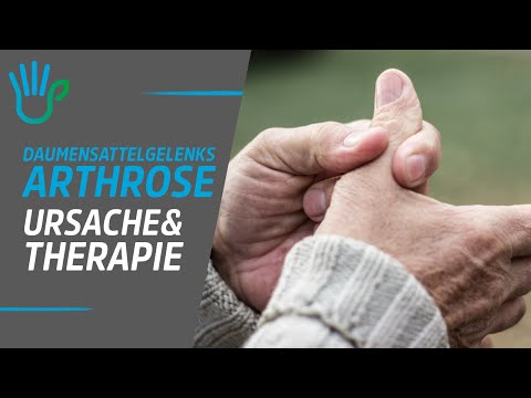Arthrose im Daumensattelgelenk / Daumengrundgelenkschmerzen - Ursache & Therapie