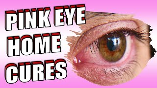 16 Powerful Pink Eye Home Remedies & Treatments | How To Get Rid of Conjunctivitis