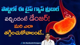 How to Get Rid of Gas Trouble | Hiatus Hernia | Acid Reflux | Relief from GERD |Dr.Ravikanth Kongara