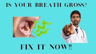 Why You Have Bad Breath & How To Fix It (Oral Hygiene)