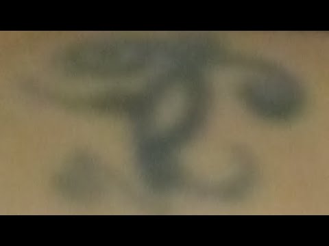 MIXXXZI - BiPolarFrogs - Freestyle