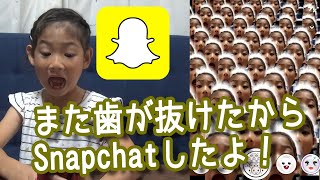 スナップチャットで報告！また歯が抜けた！【Snapchat】
