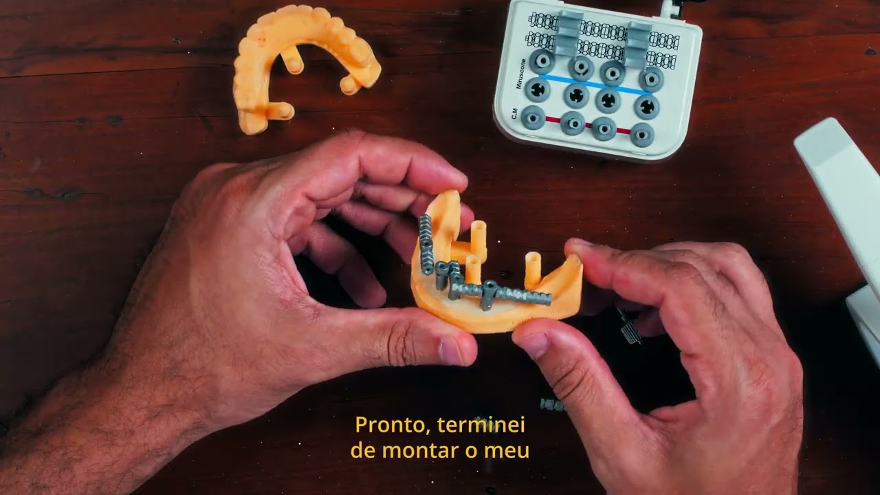 Vídeo 13 - Escaneamento para Prótese do tipo Protocolo