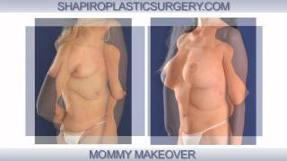 Shapiro Plastic Surgery