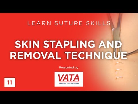 Skin Stapling and Removal Technique - Learn Suture Techniques - VATA