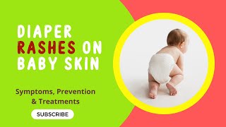 Diaper Rashes on Baby Skin- Prevention & Treatments