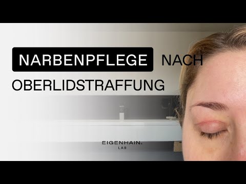 Narbenpflege nach OP - Erfahrung nach einer Oberlidstraffung (Augenlidstraffung) - LAB #17