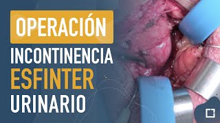 Operación de ESFINTER URINARIO para la INCONTINENCIA. Doctor Natalio Cruz. Clínica Andromedi