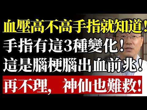 腦梗來時，“手指”竟會提前“拉警報”？醫生鄭重警告：手指3大“求救信號”，再當成小毛病，恐一睡不醒！#高血壓 #腦梗 #中風 #腦中風 #手麻 #心血管 #健康 #養生 #醫生警告 #前兆手指