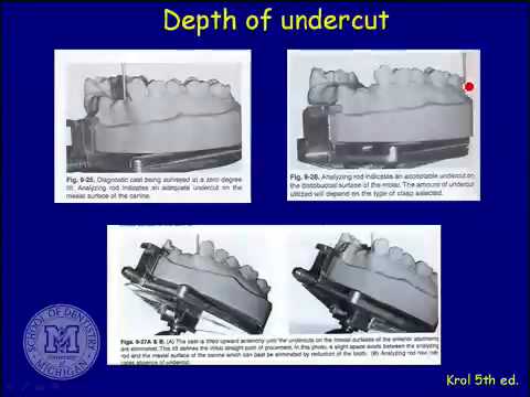 Repairing Complete and Partial Dentures