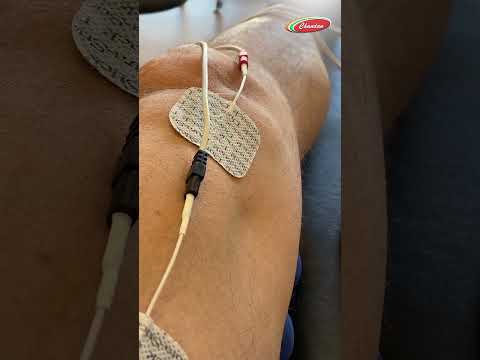 Tingling or Numbness in Hands & Feet? Know Why You Need an NCV Test | Dr. Ranjan Kumar