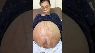 Download lagu Big Stomach Not Because of Black Magic😱⁉️#entertainment #shortvideo #shorts #viral #indonesia mp3