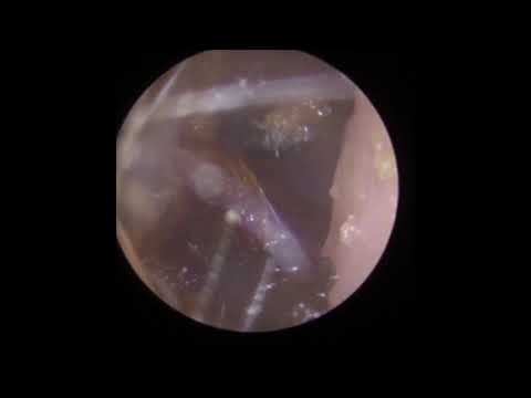 Gentle wax removal with Jobson Horne.