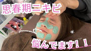 【悩み】思春期ニキビガールちゃんの肌を改善したい！！