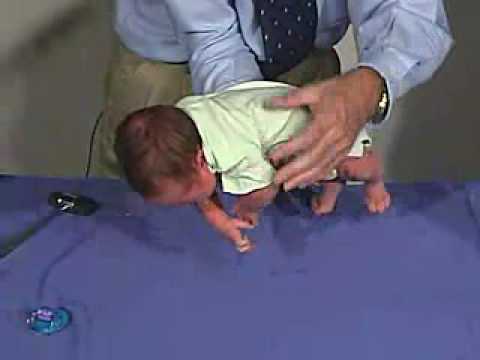 physical exam -Newborn Normal: Positions-Ventral Suspension