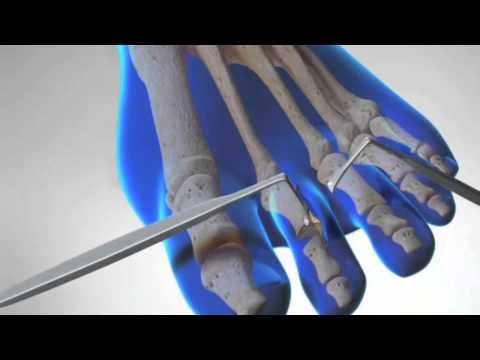 Esercizi per il collo osteocondrosi malati Dolori e dello stomaco e schiena