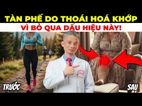 99% Người Việt Bị Thoái Hoá Khớp Gối Chỉ Vì Bỏ Qua Dấu Hiệu Này!