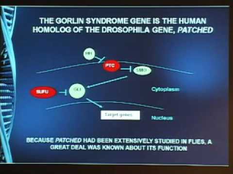 Genetic and Genomic Approach to Deciphering Skin Cancer