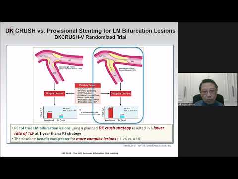 Controversy: Is DK Crush the Gold Standard for complex distal LM stenosis?       Yes - Dr T. Santoso