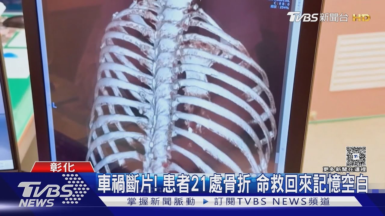 婦遭休旅車輾壓「全身21處骨折」斷片　4次手術奇蹟生還