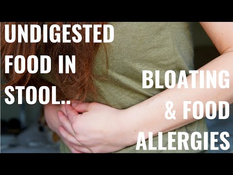 Undigested Food in Stool, Bloating and Food Allergies from HCLF Vegan & Ketogenic Diets
