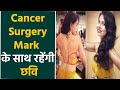 Chhavi Mittal ने किया अपने Breast Cancer Surgery Mark को Flaunt Photos Viral