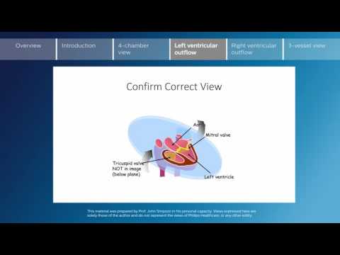Key screening views of the fetal heart - Part 4 - Left ventricular outflow