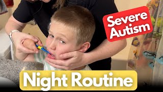 Nighttime Routine | What Severe Autism Really Looks Like