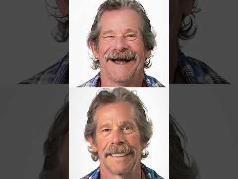 Logo of Detailed Overview of the Full Mouth Dental Implants Procedure in Los Algodones, Mexico