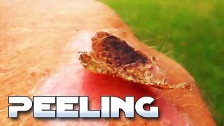 Picking and Peeling Scabs (Educational, NSFE)