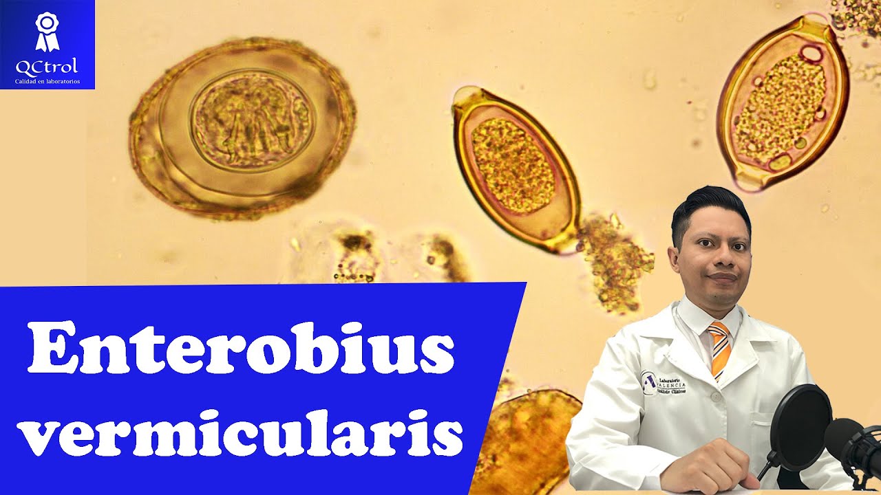 Meet Enterobius vermicularis (Pinworm): Graham Test and adults🔬