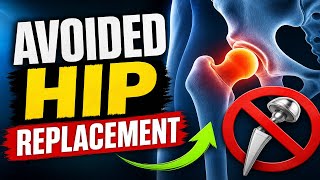 How You Can Avoid a Hip Replacement Surgery Too