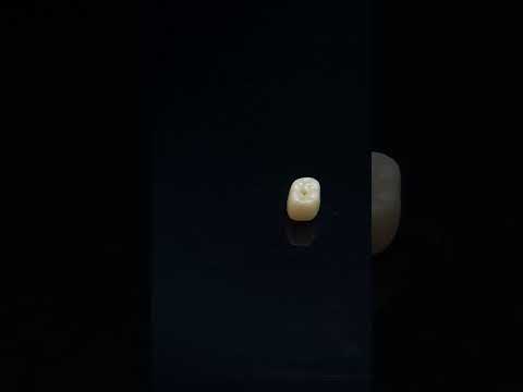 YouTube 썸네일