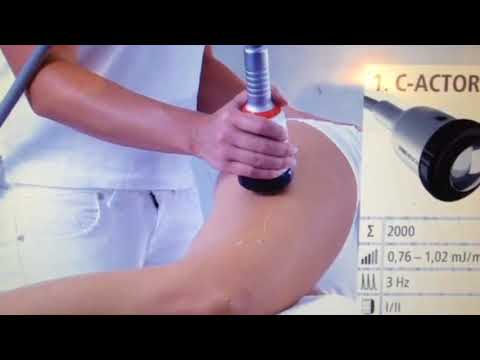 Процедура на аппарате Duolith SD1