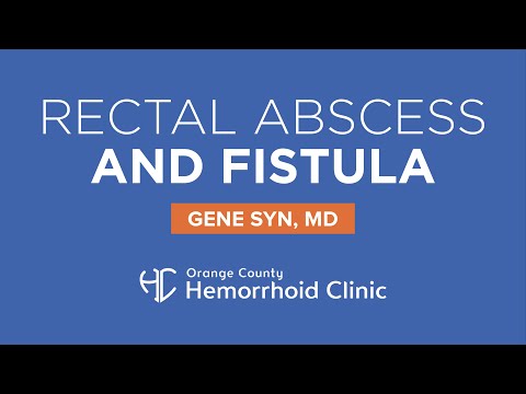 Rectal Abscess and Fistula by Gene Syn, MD - Orange County Hemorrhoid Clinic
