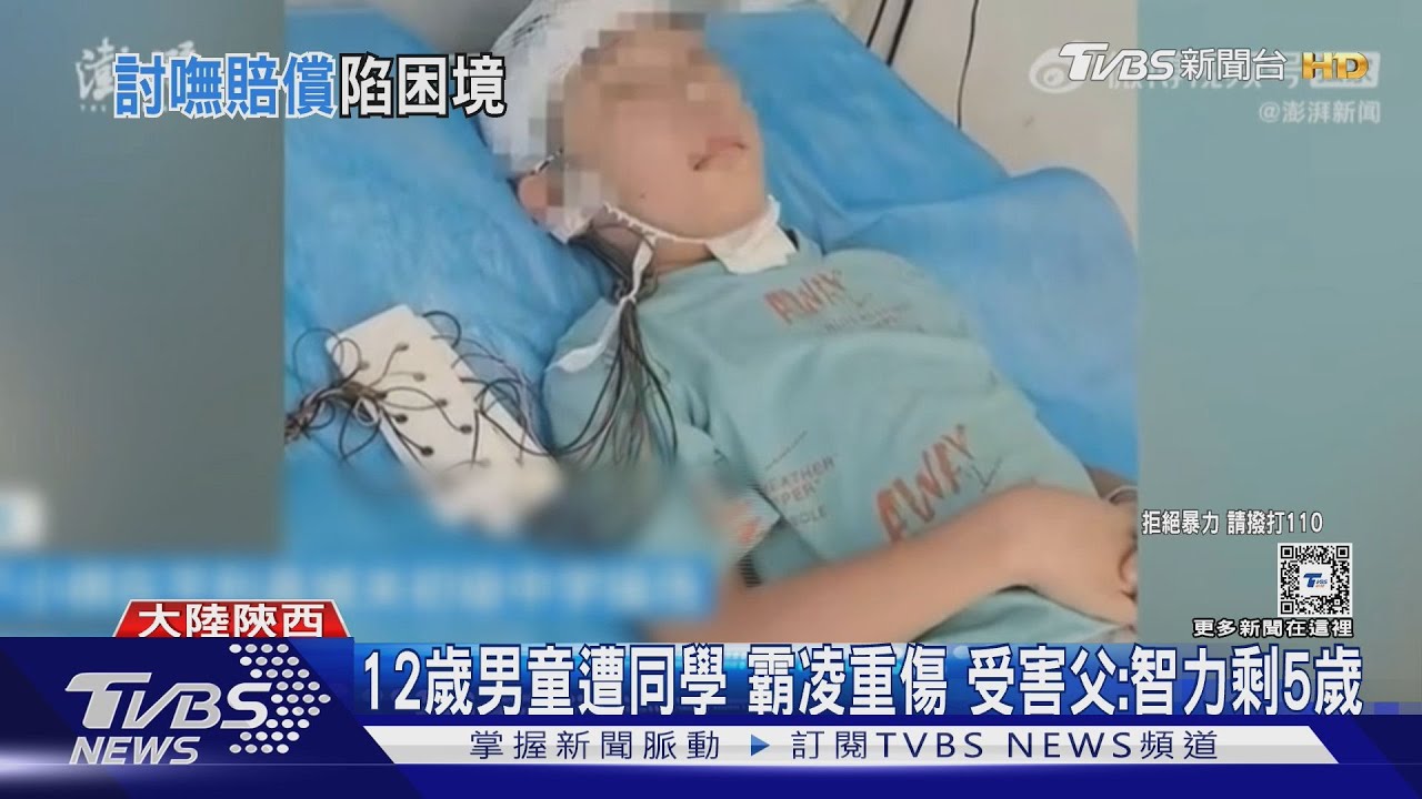 12歲男童遭同學霸凌重傷 受害父:智力剩5歲