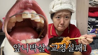 교정 말아먹고 먹는 마라탕