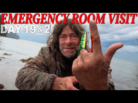 Greg Days 19 & 20 BAD Hook Injury Medical Emergency | 30 Day Survival Challenge: Vancouver Island