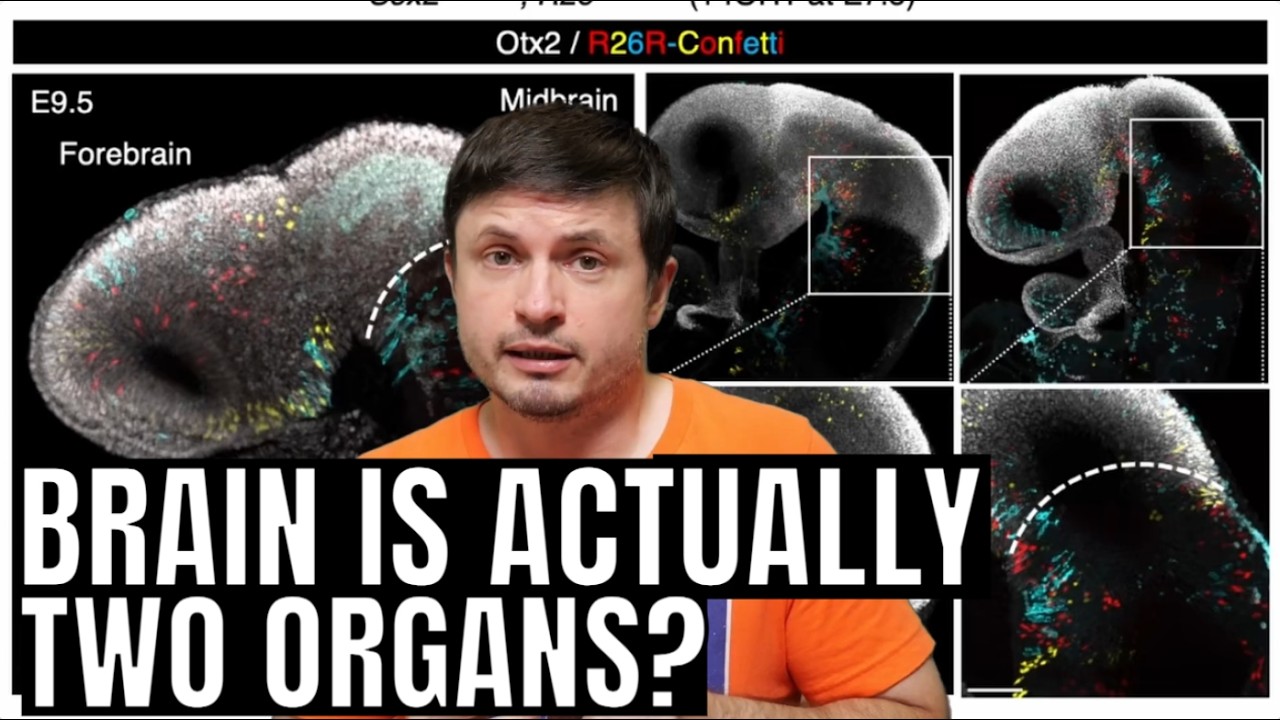 The Human Brain Turned Out to Be Two Separate Organs