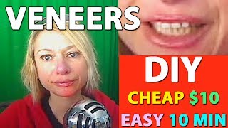 DIY VENEERS / CHEAP  $10 / EASY 10 MIN / DIY AT HOME Update / Follow Up after 1 year use