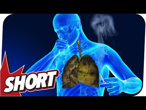 Behandlung von Prostatitis bei Männern Finalgon Erektile Dysfunktion und Prostatitis