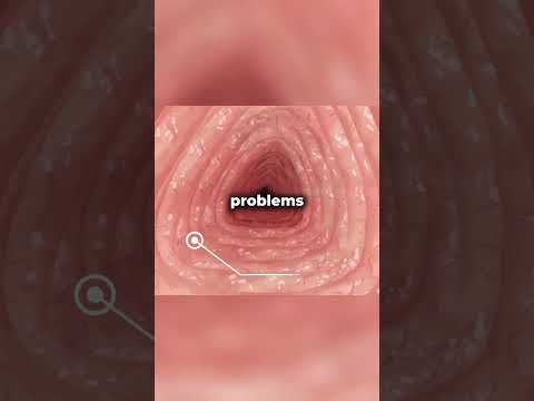 What happens if you drink bleach ? 😮 [EXPLAINED]