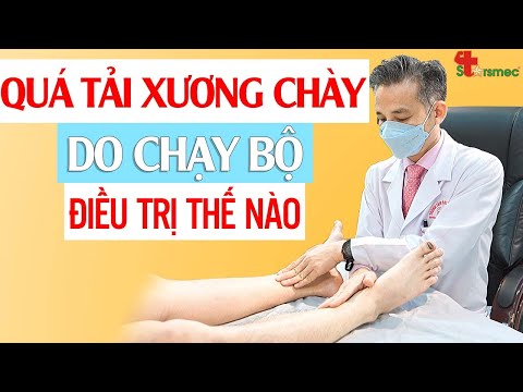 Qúa tải xương chày do chạy bộ - Điều trị và chăm sóc thế nào? 
