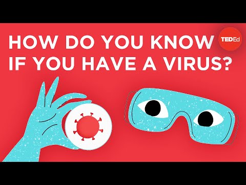 איך בודקים אם יש וירוס בגוף האדם?