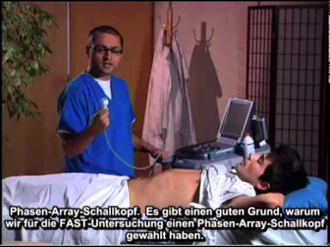 Die für Schmerzen im Knie fragen Analgetikum als Lendenschmerzen