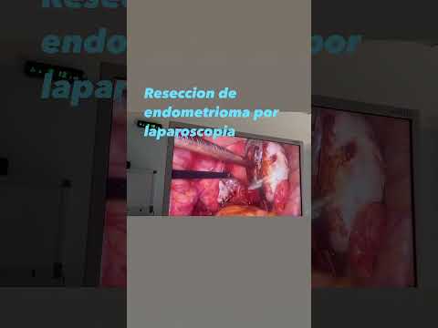 Guilliatt Nicolas Gonzalez Hernandez-5