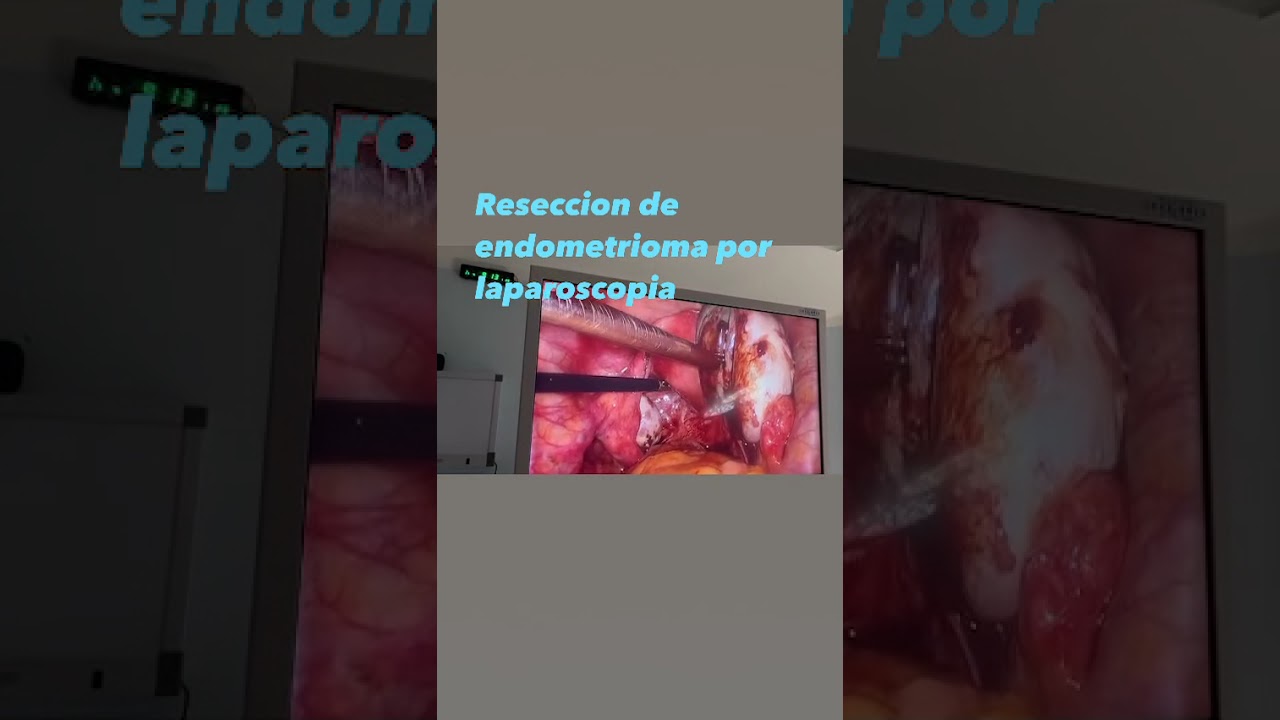 Guilliatt Nicolas Gonzalez Hernandez-5