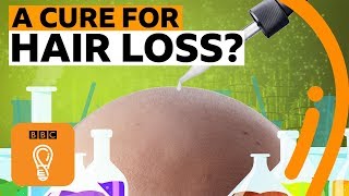 Why is there no cure for hair loss? | BBC Ideas