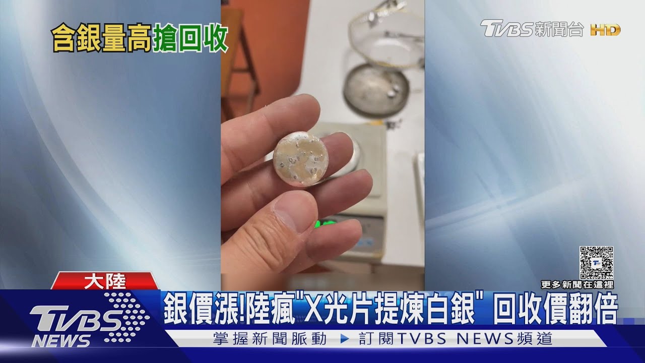 銀價狂飆催生「另類淘銀術」 X光片回收價暴漲250%