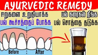 How To Heal Receding Gums |Treat Sensitive Teeth and Reverse Receding Gums | Grow Back Receding Gums